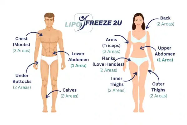 Areas you can have fat freezing treatment Worcestershire