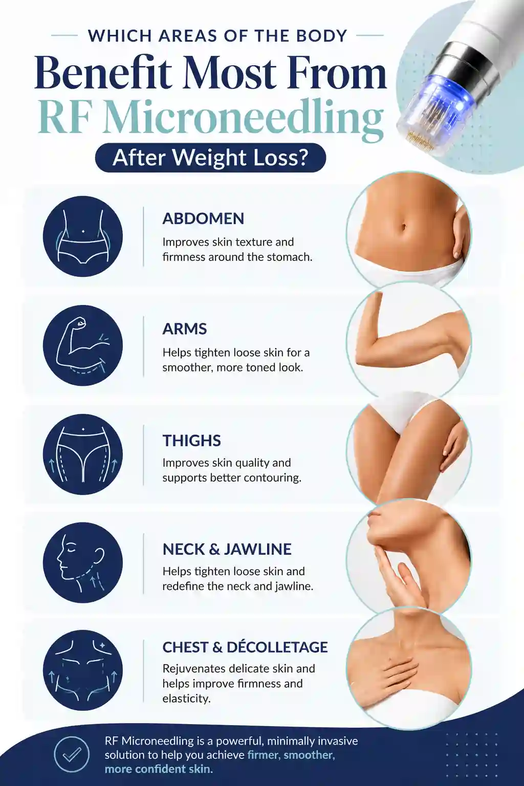 Which Areas of the Body Benefit Most From RF Microneedling After Weight Loss Worcestershire
